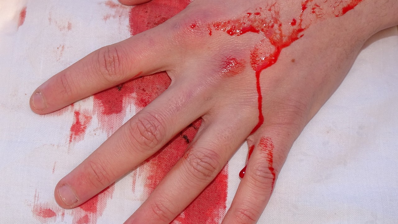 Pr&egrave;s de Grenoble : un homme poignard&eacute; op&eacute;r&eacute; en urgence